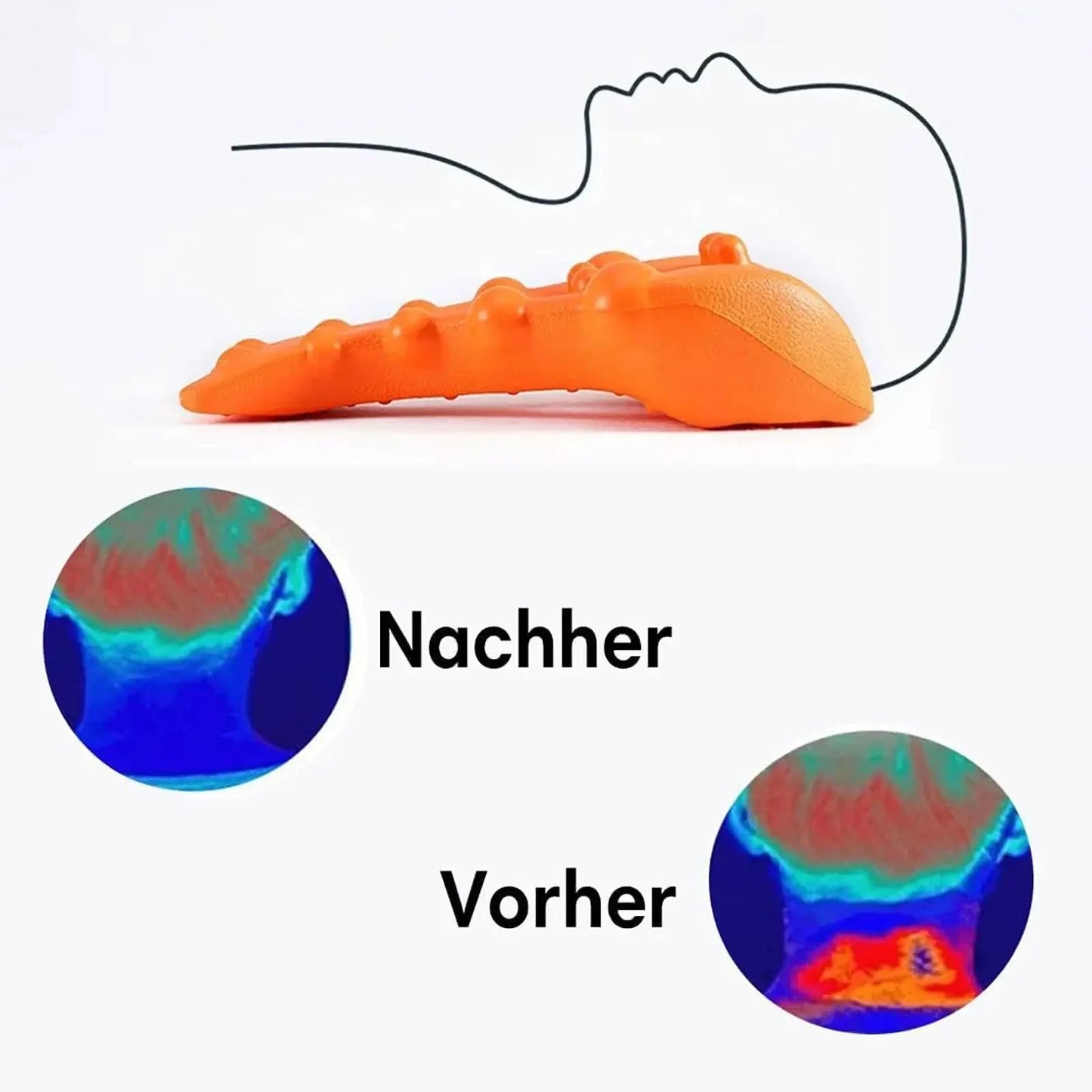 Close-up of cushioned neck stretcher showing ergonomic support design